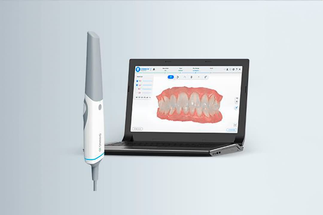 Scanner intraoral exibindo a arcada dentária digitalizada na tela